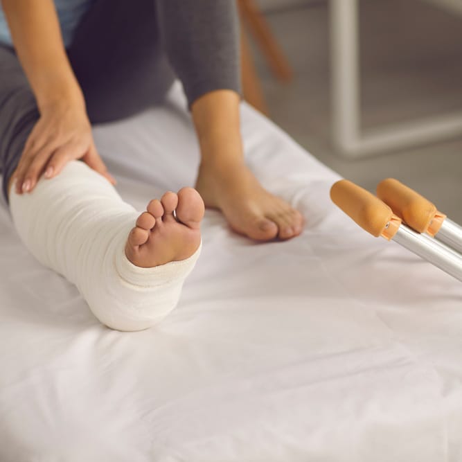 Jambe plâtrée et béquilles : Conseils de convalescence Femme assise sur un lit avec une jambe plâtrée et des béquilles à proximité, en période de convalescence.